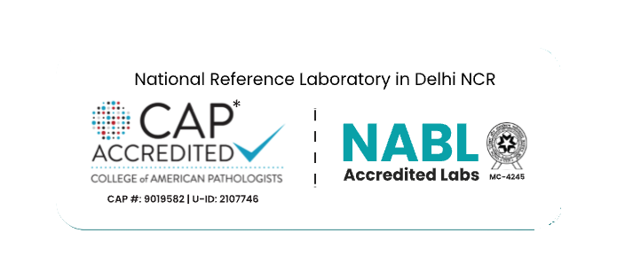 National Reference Laboratory - CAP & NABL Accredited